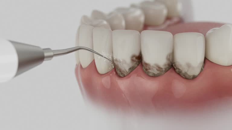 Reliable Dental Implants contractor in Greenfields, PA by Smile Center Dentistry